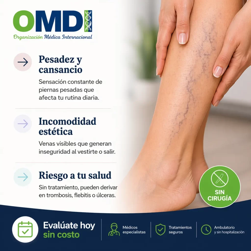 tratamientos-para-varices